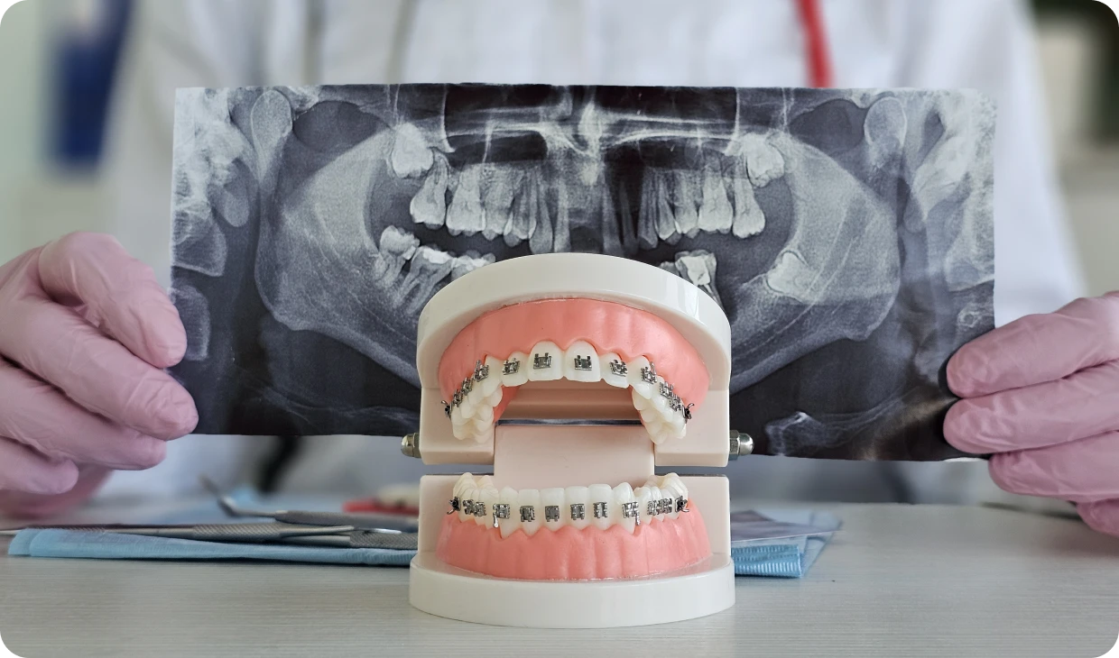 Dentist holding dental X-ray and model