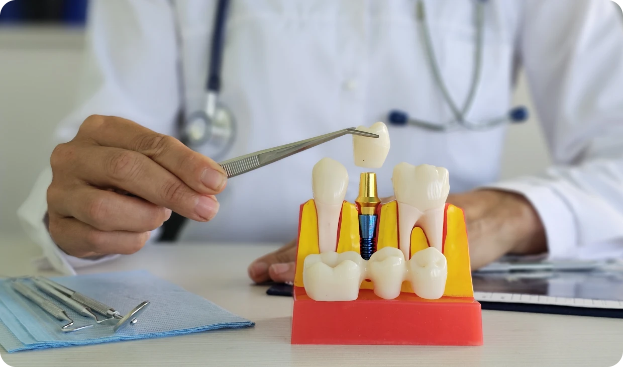 Dentist showing tooth implant model