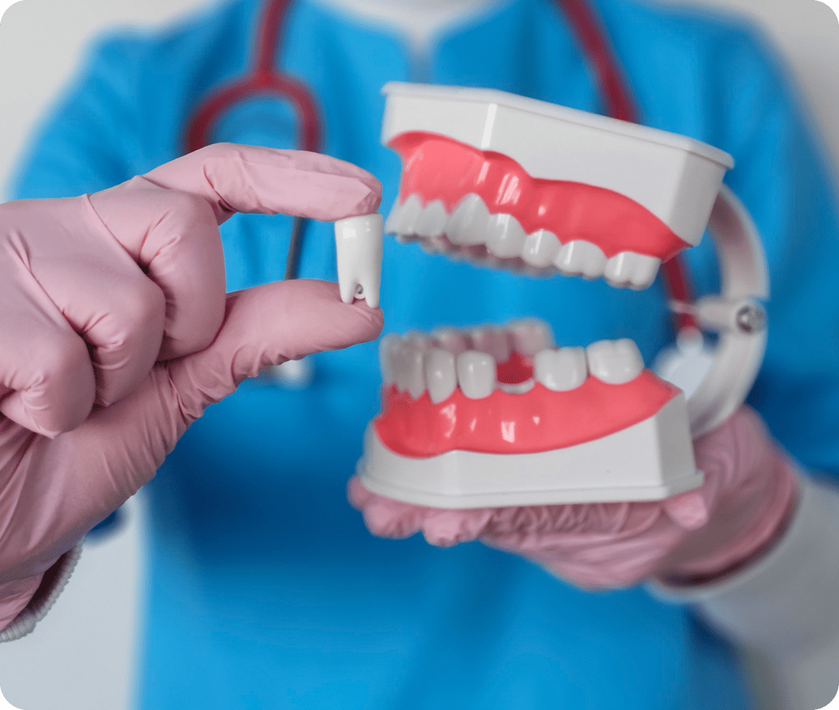 Dentist holding artificial teeth model
