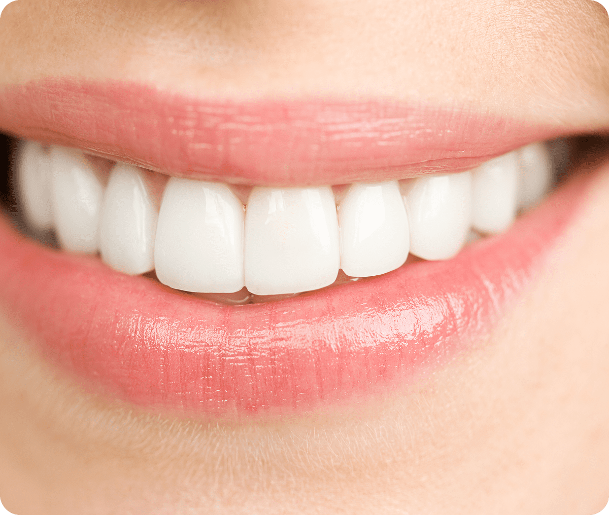 Close-up of healthy teeth and lips