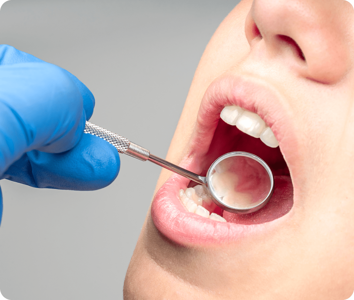 Dentist examining open mouth